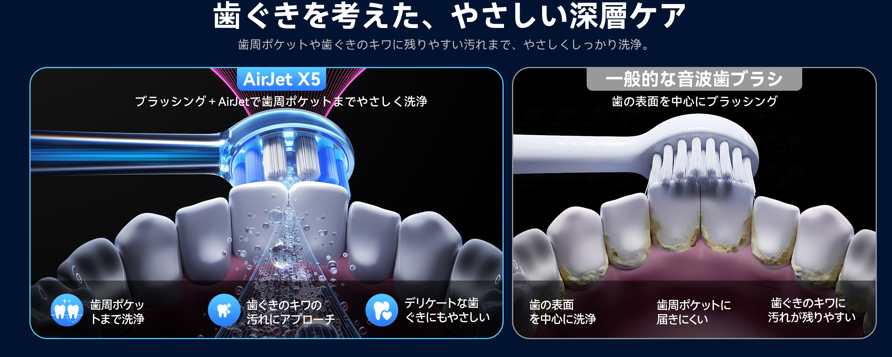 Amazon.co.jp: 【歯周ケア特化 次世代バブルジェット洗浄】RANVOO